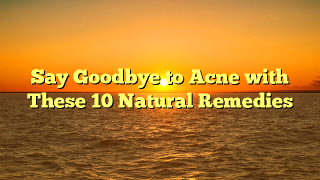 Say Goodbye to Acne with These 10 Natural Remedies